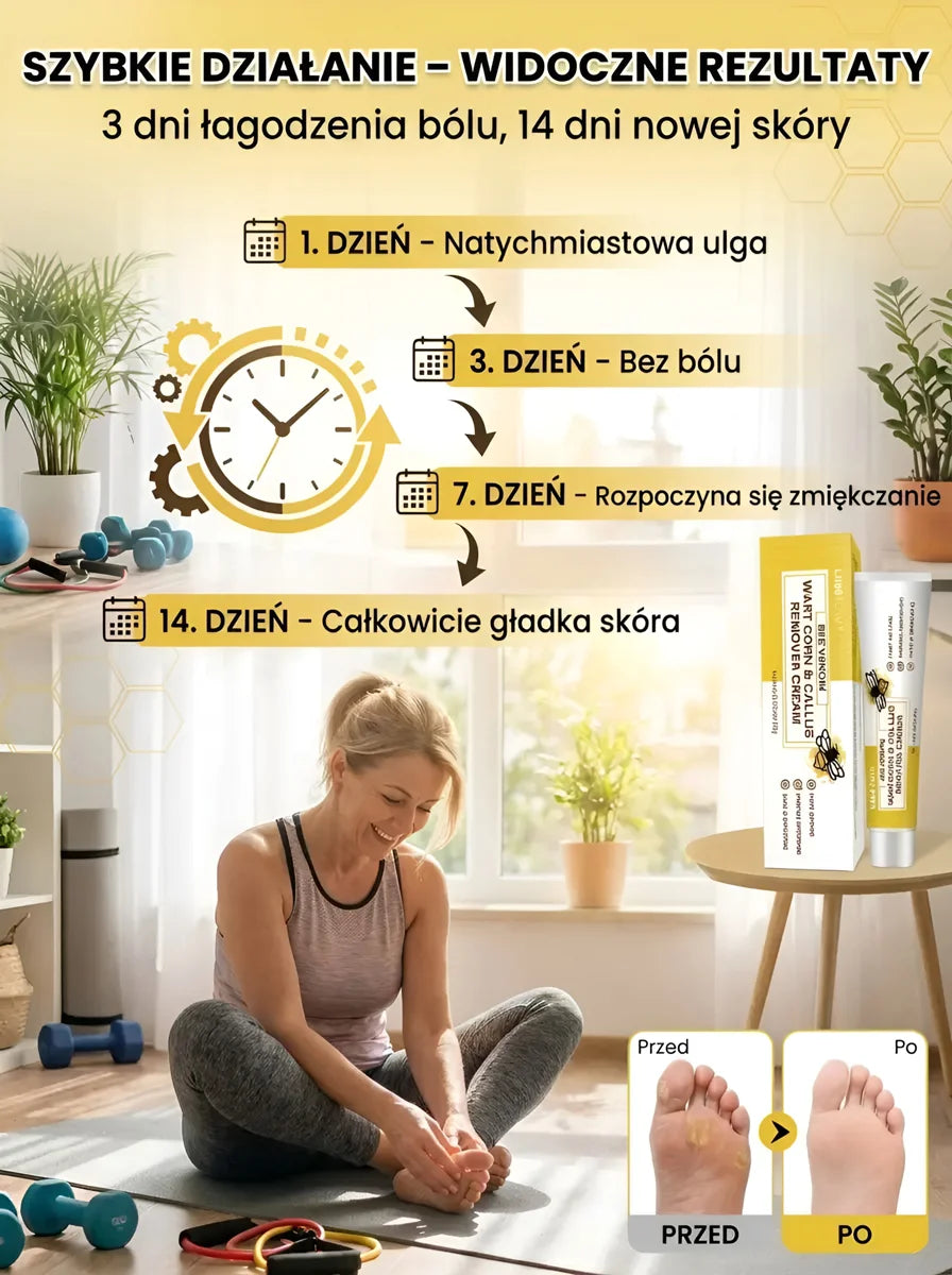 🐝🦶 Krem do usuwania modzeli oraz odcisków z naturalnym jadem pszczelim