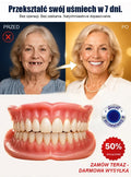 🦷✨😁 Premiumowy komplet protez zębowych – trwałe, wygodne i naturalnie wyglądające uzupełnienie uzębienia